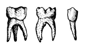 Dents - Tattoonie