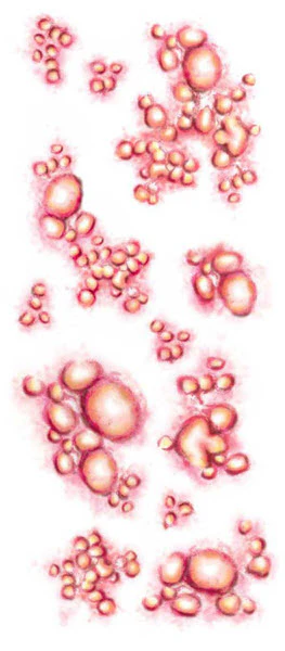 Diseased - Trauma Tattoos - Image 2