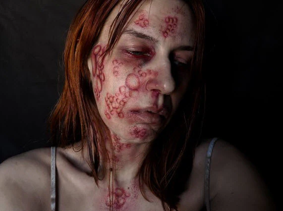 Diseased - Trauma Tattoos - Image 4