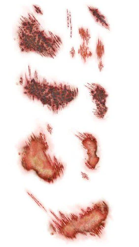 Road Rash - Trauma Tattoos - Image 2