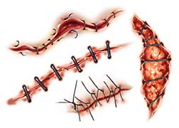 Scary Stitched Wounds Tattoos